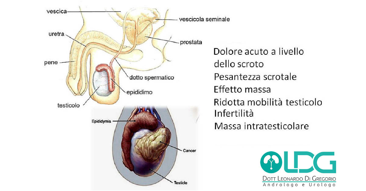 masse scrotali