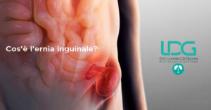 ernia inguinale