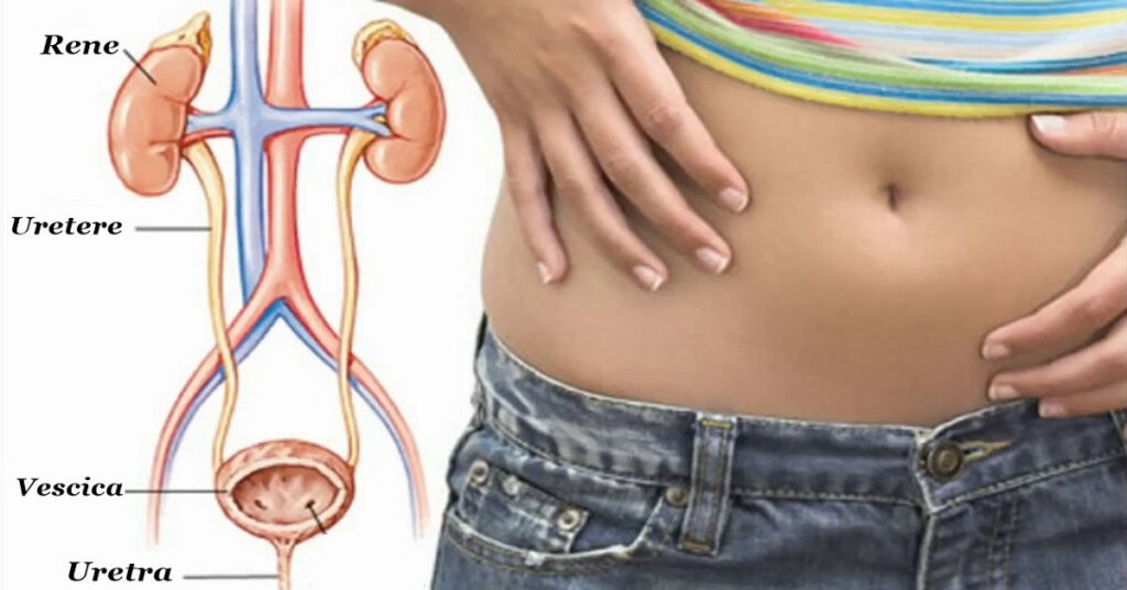 infezioni vie urinarie femminili