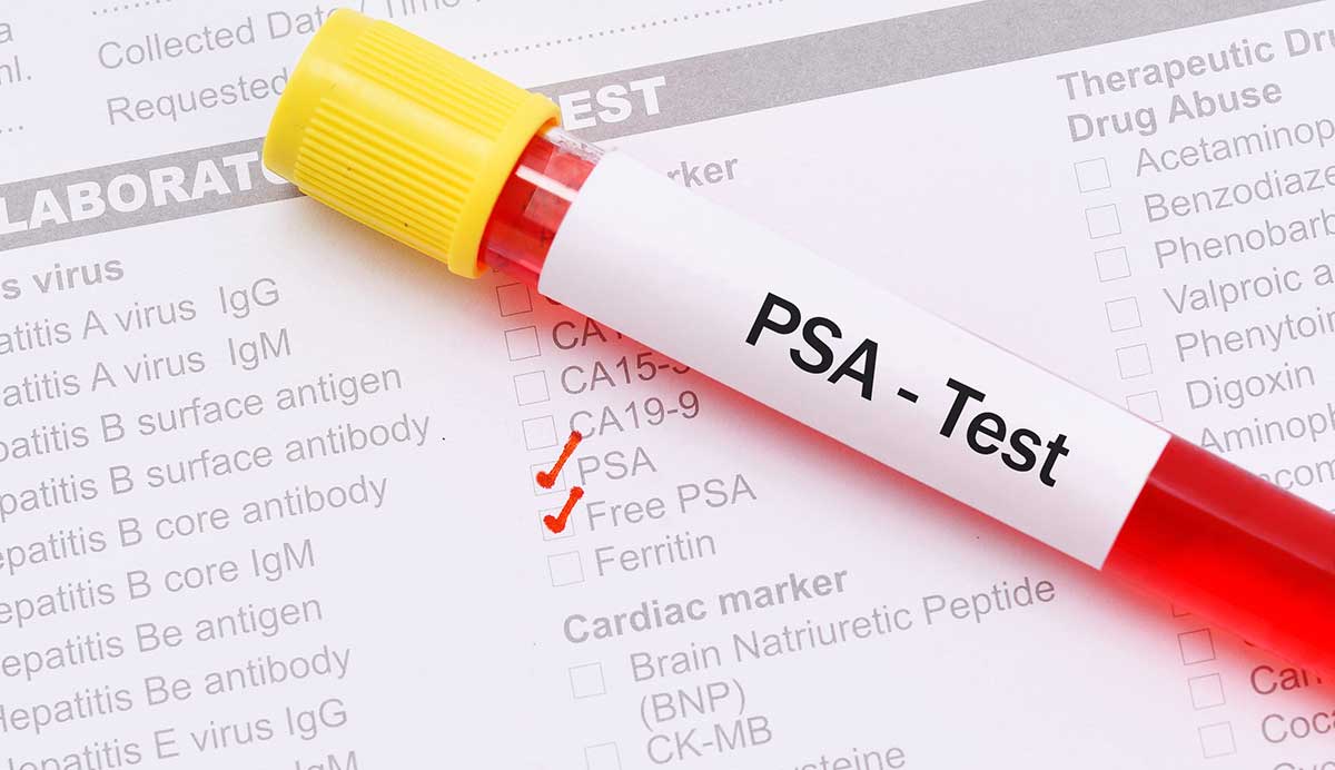 test psa