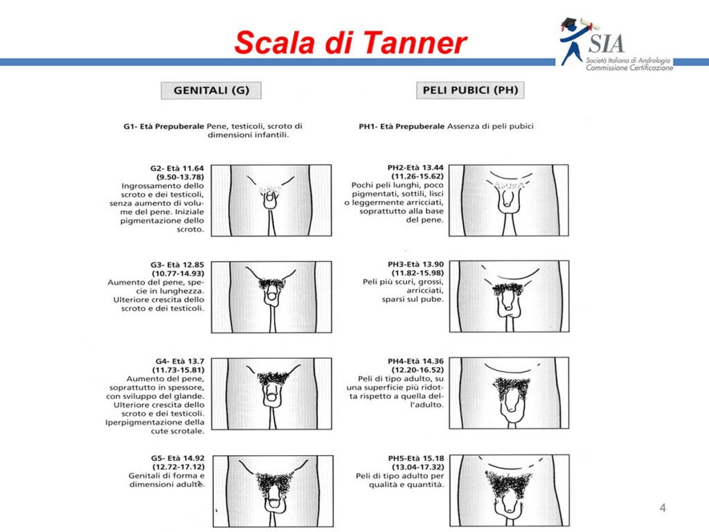 scala di tanner